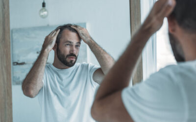 The Link Between Low Testosterone and Hair Loss
